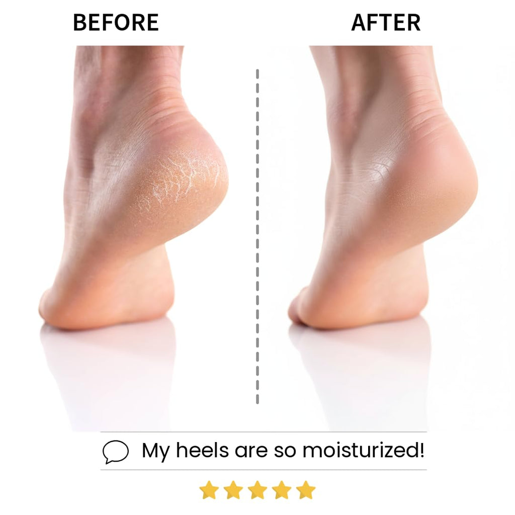 Relaxing Aroma Foot Mask, Home Spa Moisturizing Pedicure Socks, 6 Pairs, For Dry Cracked Heel, Hydrating Foot Treatment, Made in Korea (Lavender)