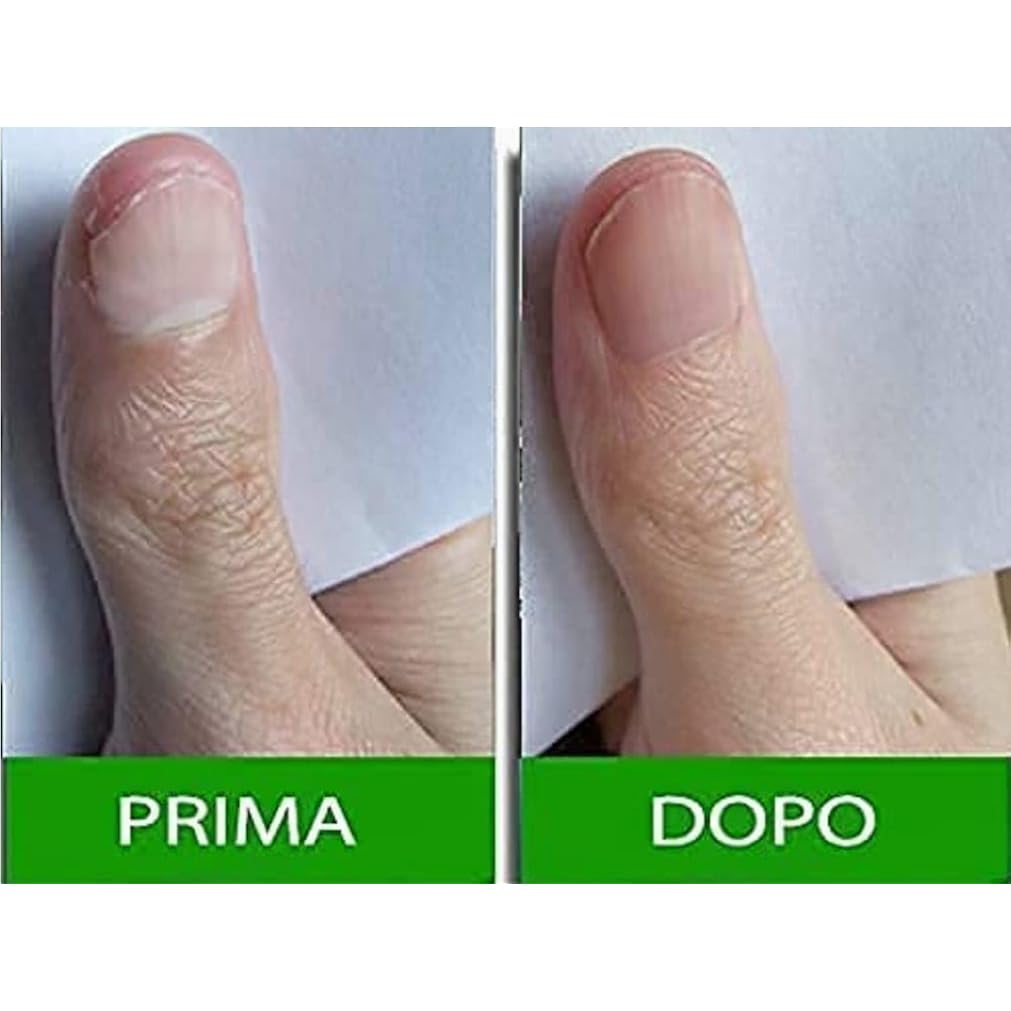 Pantogar Specific Treatment For Hair And Nails 90 Caps