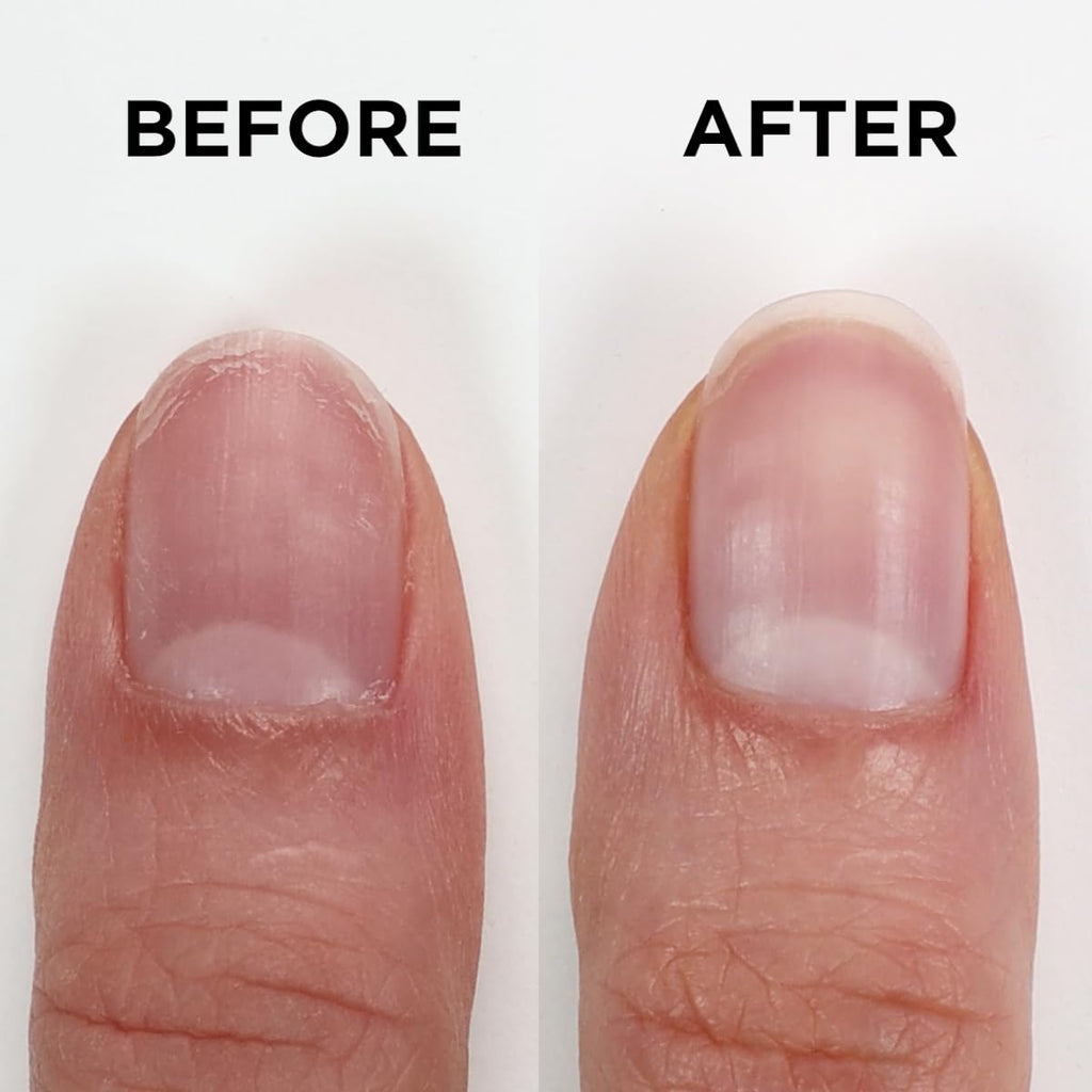 ORLY Nailtrition Nail Growth Treatment | Enhances Growth | Repairs Weak Nails | Improves Nail Health By Reducing Splits, Chips, Cracks (0.6fl oz)