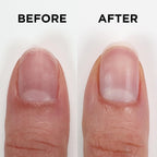 ORLY Nailtrition Nail Growth Treatment | Enhances Growth | Repairs Weak Nails | Improves Nail Health By Reducing Splits, Chips, Cracks (0.6fl oz)