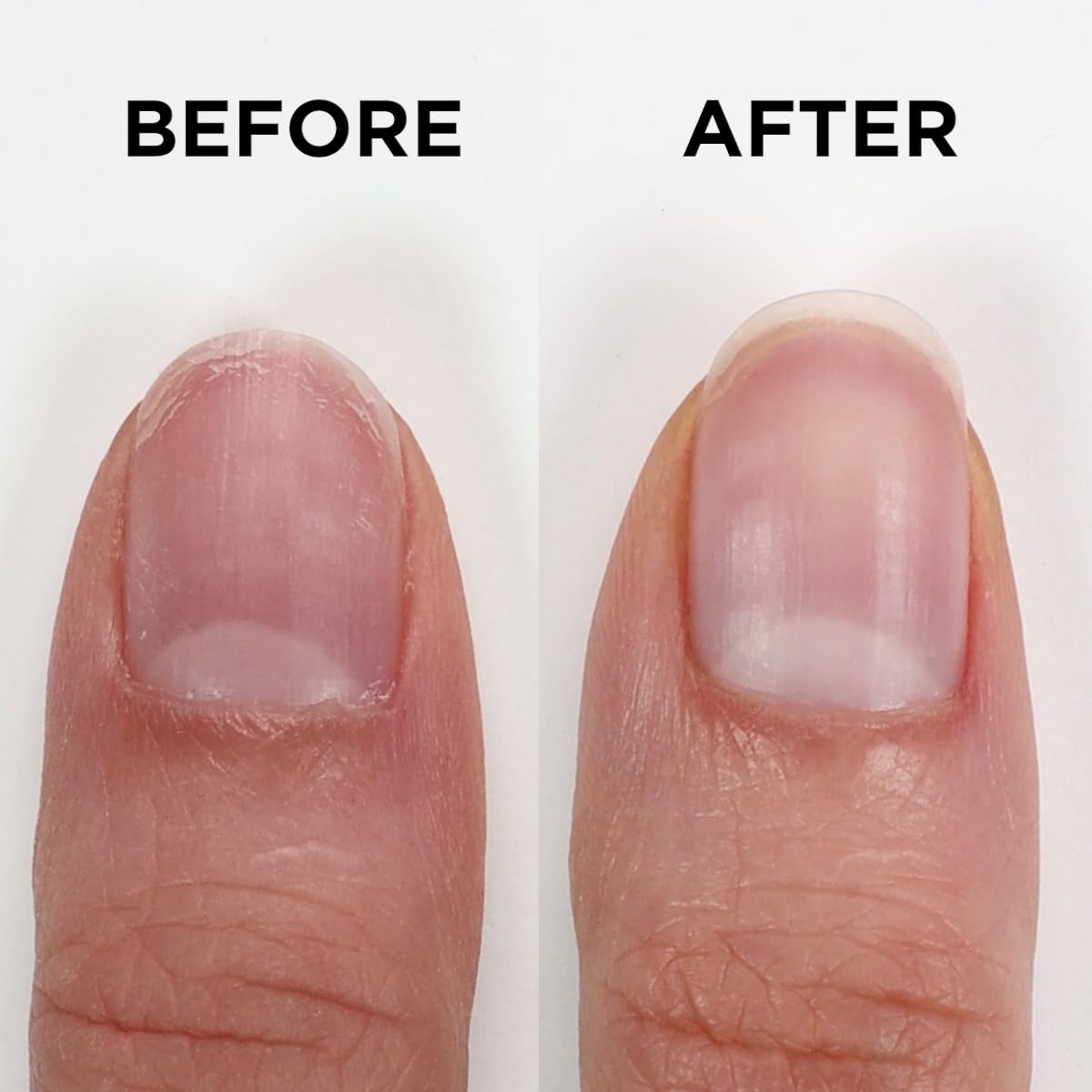 ORLY Nailtrition Nail Growth Treatment | Enhances Growth | Repairs Weak Nails | Improves Nail Health By Reducing Splits, Chips, Cracks (0.6fl oz)