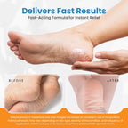 Revitaderm 4D 40% Urea Advanced Foot Cream for Cracked Heels & Dry Skin, Intensive Repair for Rough, Callused Feet, Fast Absorbing, Fragrance Free, Made in USA, 4 oz with Pumice & Brush, 1 Pack