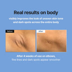 Meditherapy Retinal Skin Booster Serum 5.07 Fl Oz | Retinaldehyde, Niacinamide, Cica | Korean Hydrating Face & Body Serum For Dull, Uneven Skin, All Skin Types, K-Beauty