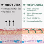 60% Urea Cream Maximum Strength, 10.1 oz - Foot & Hand Cream for Dry Cracked Skin, Callus Remover, with 2% Salicylic Acid - Deep Moisturizer for Cracked Heels, Rough Elbows & Knees - Fast Absorbing