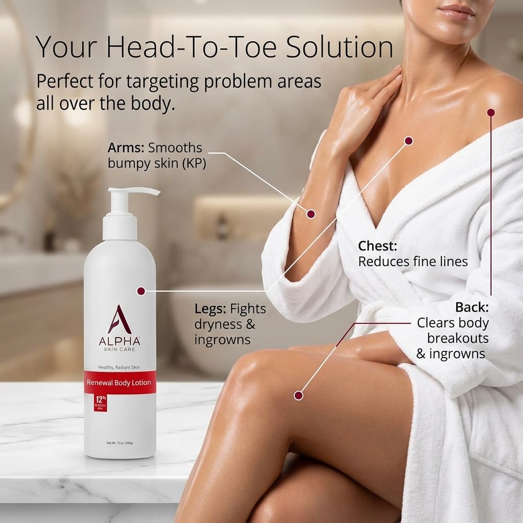 Alpha Skin Care Revitalizing Body Lotion, 12% Glycolic Aha, Simple & Effective Daily Moisturizer With Alpha Hydroxy Acid, Hydrates & Exfoliates For Soft, Smooth Skin, Anti-Aging, 12 Oz