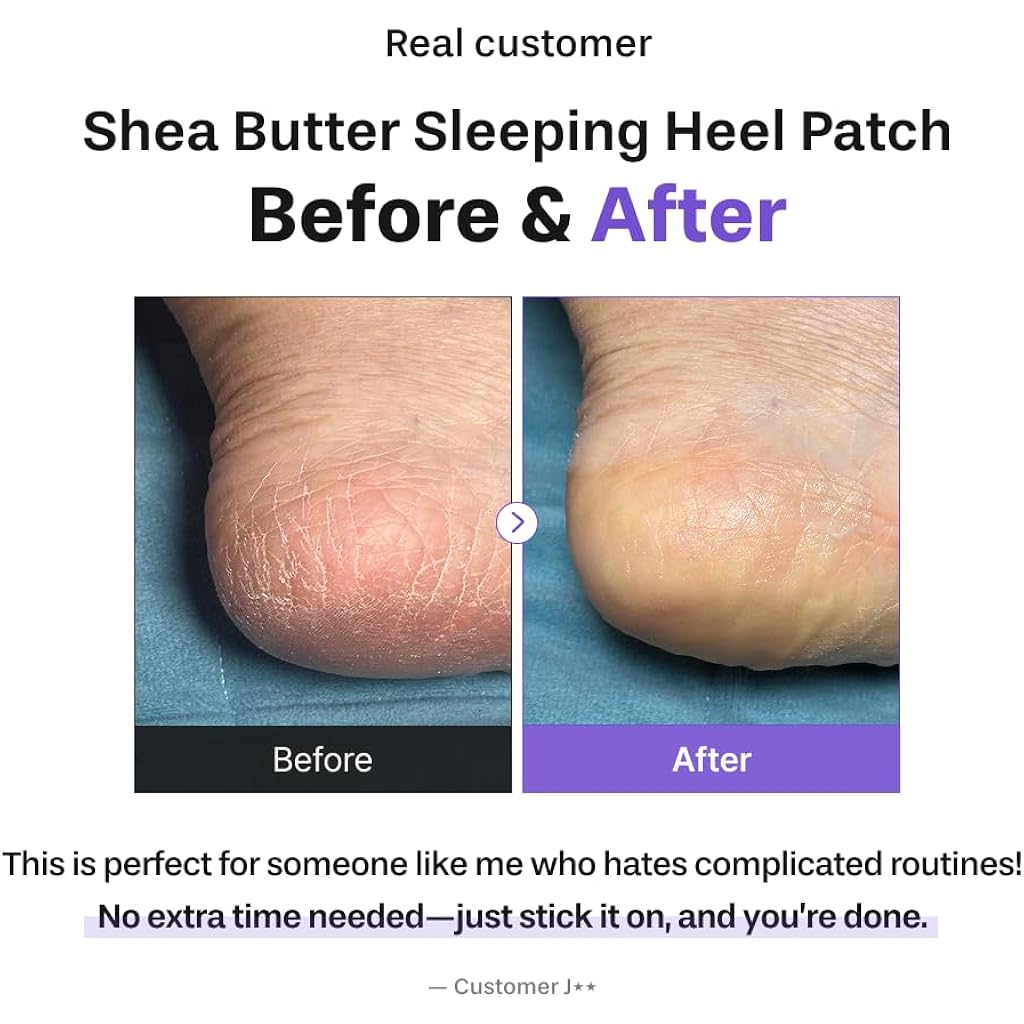 Baren Shea Butter Heel Repair Patch for Cracked Dry Heels, Overnight Foot Moisturizer Mask, Hydrating & Breathable (10pcs), K-Beauty