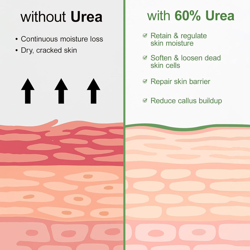 Urea Cream 60 Percent For Feet Maximum Strength Plus Salicylic Acid 2%, Tea Tree Foot Lotion For Dry Feet, Foot Cream Intensive Repair Foot Moisturizer 5.29oz