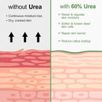 Urea Cream 60 Percent For Feet Maximum Strength Plus Salicylic Acid 2%, Tea Tree Foot Lotion For Dry Feet, Foot Cream Intensive Repair Foot Moisturizer 5.29oz