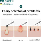 MR.GREEN Ingrown Hair Tweezers Needle Nose Pointed Tips Tweezers For Eyebrows Splinters Blackhead Removal Acne Clip Extractor (Long)