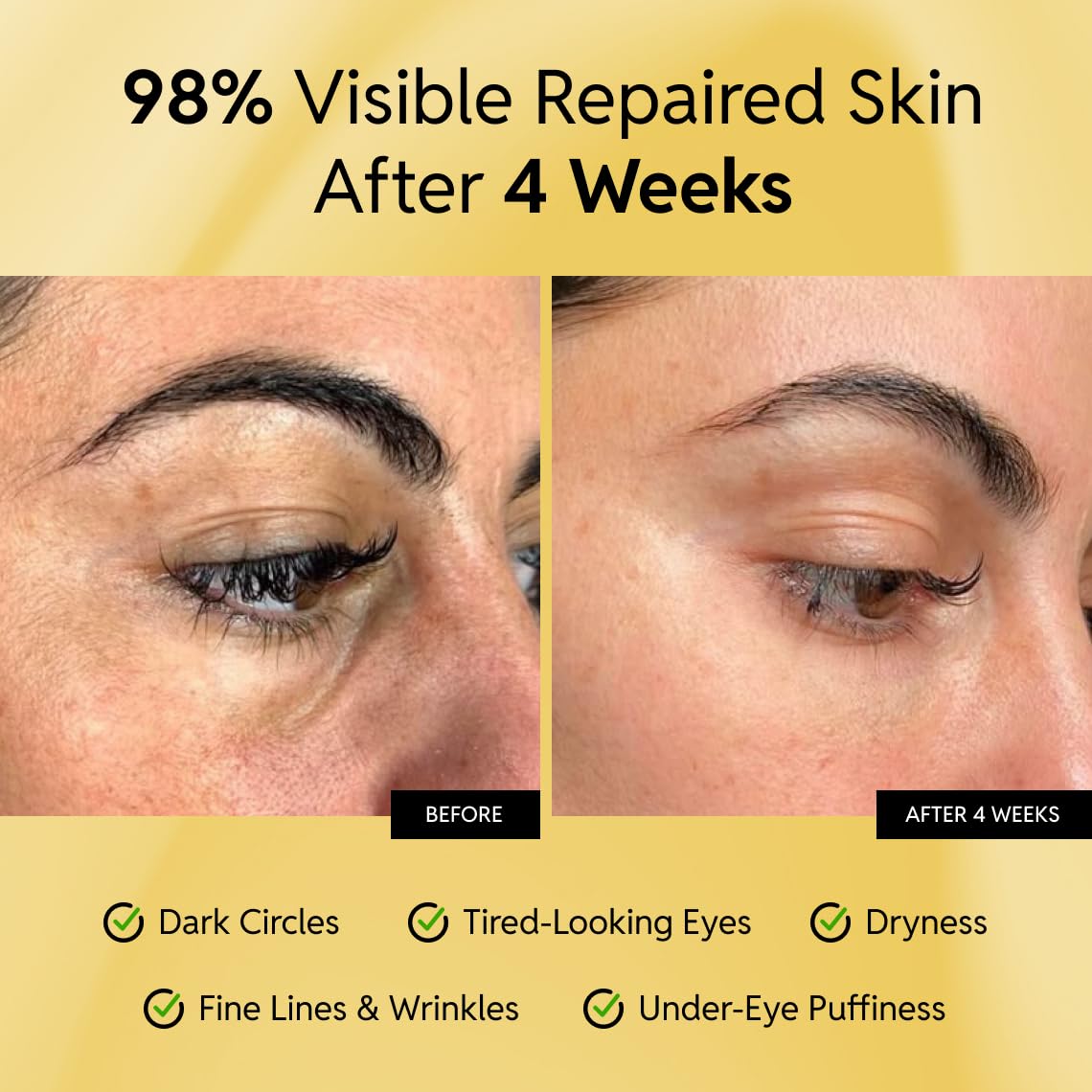 Eliré Repair Eye Cream - Restores And Strengthens Delicate Under-Eye Skin - With Ceramides And Caffeine - Reduces Fine Lines, Wrinkles And Puffiness - Fast-Absorbing - Dermatologist-Tested - 15Ml