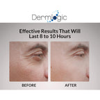 Under Eye Puffiness & Dark Circles Rapid Treatment- Instantly Reduces The Appearance Of Puffy Eye Bags, Crow’S Feet, & Sagging Skin.