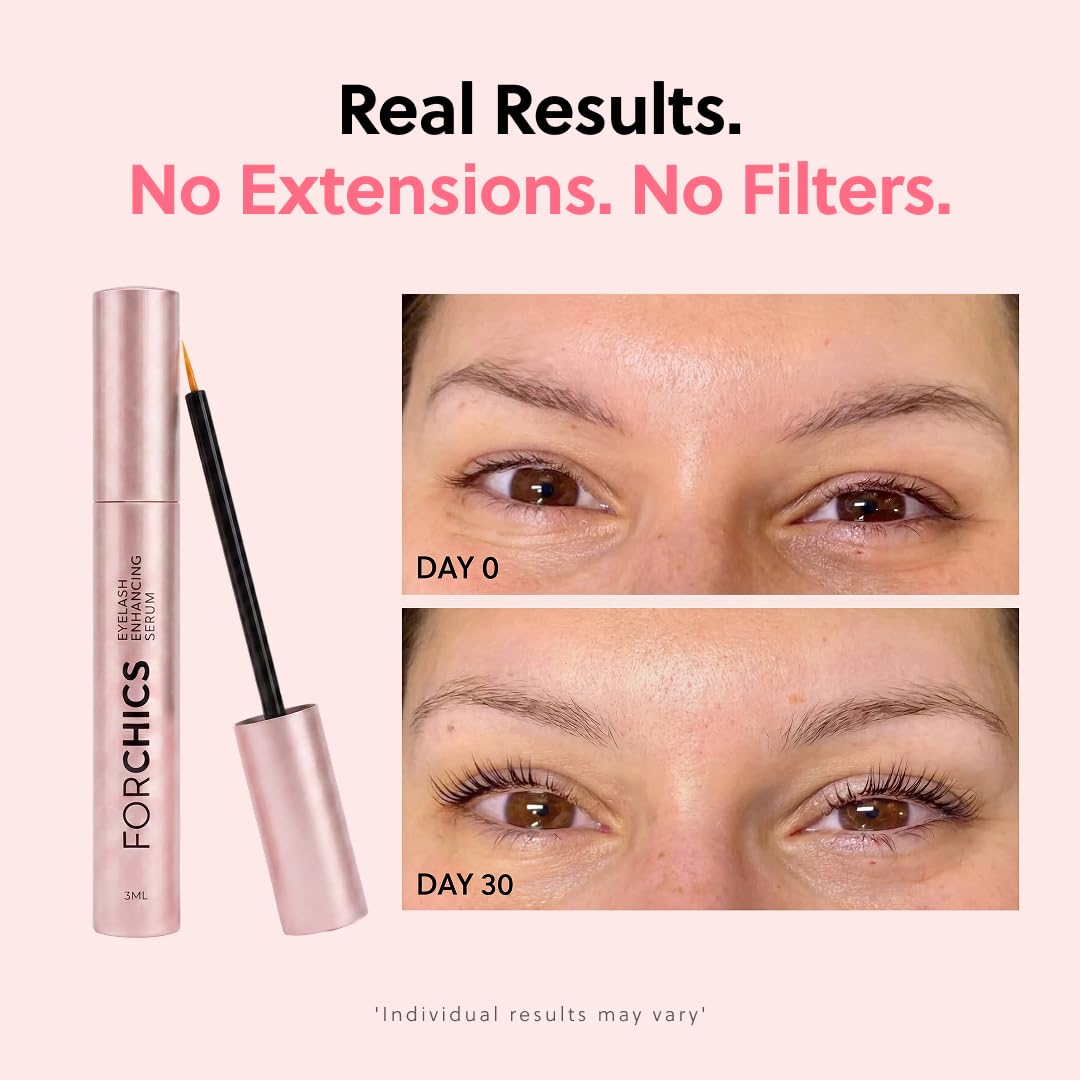 ForChics Eyelash Growth Serum - Prostaglandin-Free Lash Enhancing Serum for Longer, Thicker Lashes and Brows- Natural Formula, Visible Results in 2 Weeks - Vegan, Hormone-Free 0.10 fl. oz / 3ml