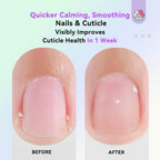 SAVILAND Soothing Cuticle Oil Pen: 6Pcs Plant-Based Nail Oil with Aloes Vitamin E Nail Strengthener Refreshing Nail Growth Serum Cuticle Softener for Moisturizing Repairing Dryness Redness Peeling