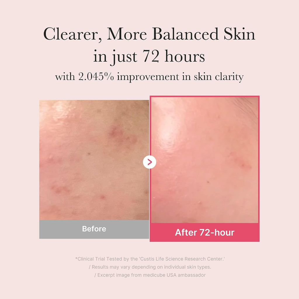 Medicube Txa+Niacinamide 15% Glow Facial Serum For After Spot Care | All-In-One Daily Korean Skincare | Uneven Skin Tone, Texture, And Hydration Care | High-Potency Tranexamic Acid 5% | 1.01 Fl.Oz