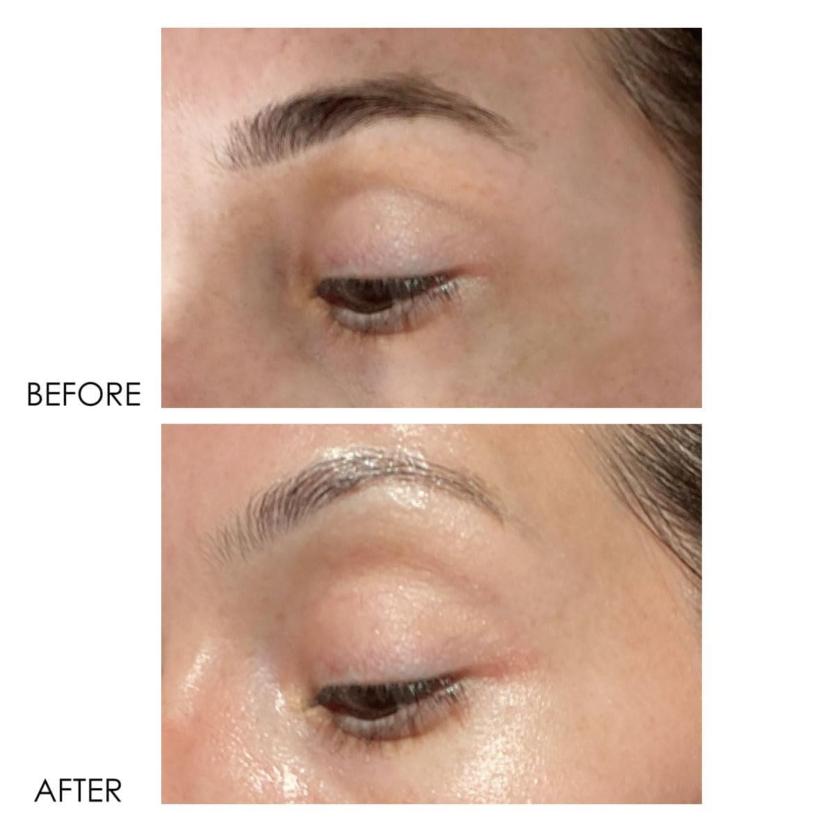 Dermelect Revitalite Eyelid & Dark Circle Corrector- Professional Strength, Anti-Aging Eye Cream With Peptides, Brightening & Tightening Ingredients- Dark Circles, Puffiness, Droopy Eyelids & Wrinkles