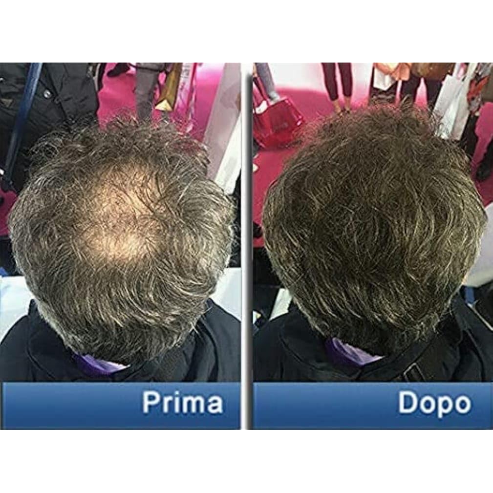 Pantogar Specific Treatment For Hair And Nails 90 Caps