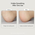Buffout Callus Eraser Exfoliating Gel – Body Care Exfoliator Scrub & Exfoliant For Feet, Heels, Elbows & Knees – Dead Skin Care With Perlite & Apricot Seed Powder