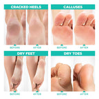 Lavinso Foot Peel Mask for Dry Cracked Feet – 2 Pack Peeling Mask Removes Dead Skin and Calluses - Exfoliating for Soft Baby Feet, Original Scent