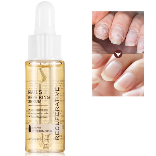 7 Days Nail Growth And Strengthening Serum 20ml Onychomycosis Softening Solution Nails Treatment Oil for Discolored And Damaged Nails