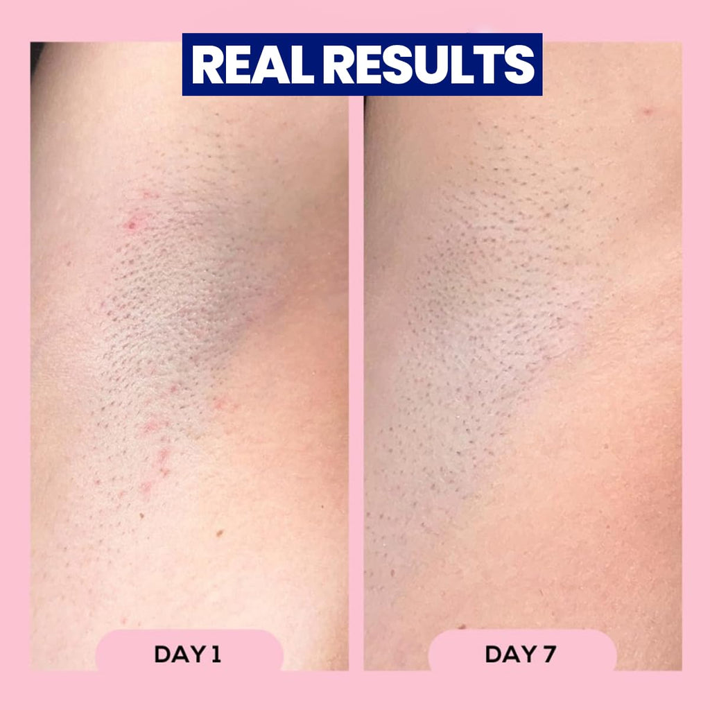 Megababe Après Shave (3.0 fl oz) | Post-Shave & Waxing | Vacation and Hot Weather Must-Have | Ingrown Hair & Razor Bump Roll-On Treatment for Women | Bikini, Armpits & Legs