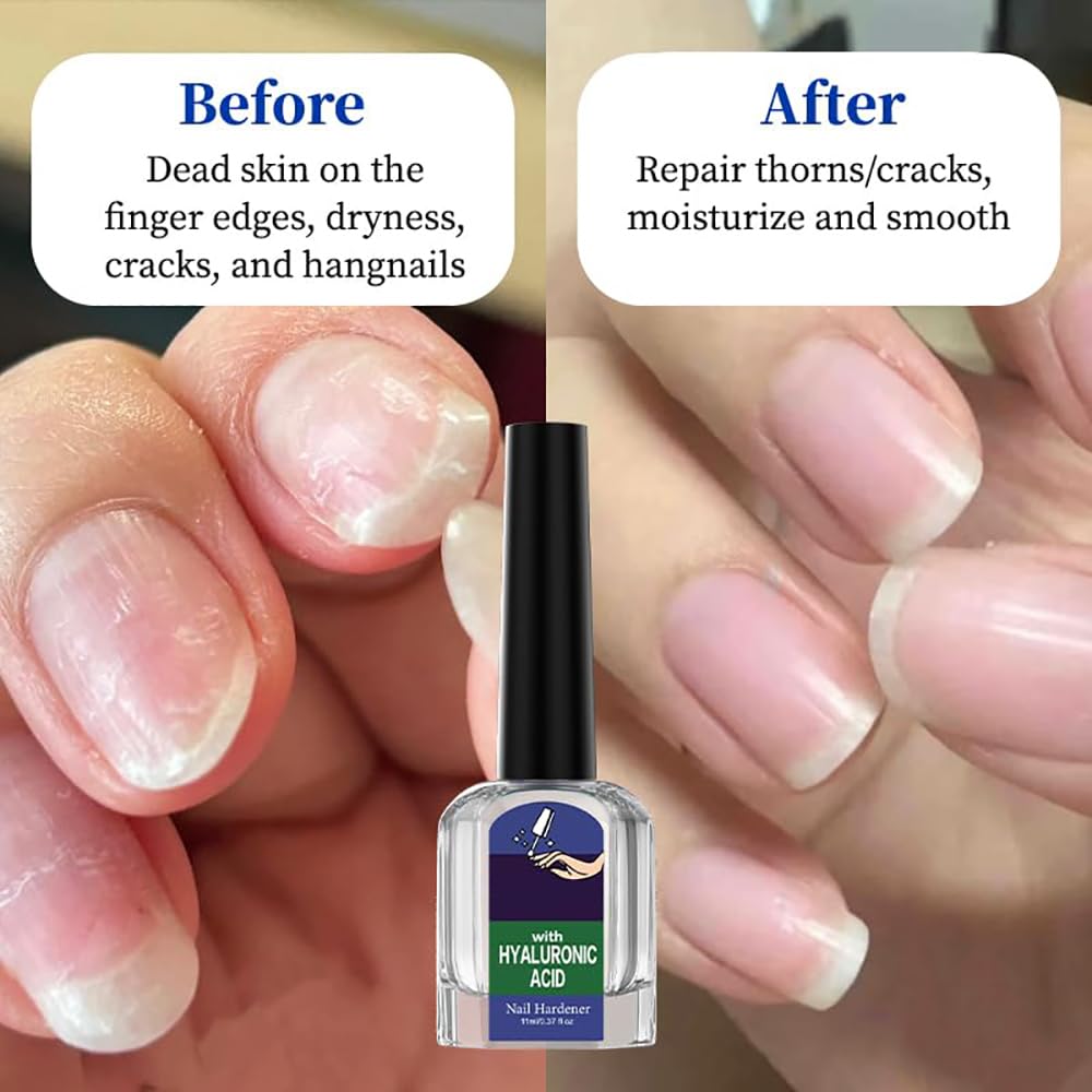 Oprtuisi Nail Care Cuticle Oil, 2-Pack Fast Absorbing Repair Serum for Cracked Cuticles, Suitable for Manicures and Home Care