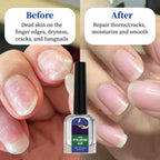 Oprtuisi Nail Care Cuticle Oil, 2-Pack Fast Absorbing Repair Serum for Cracked Cuticles, Suitable for Manicures and Home Care