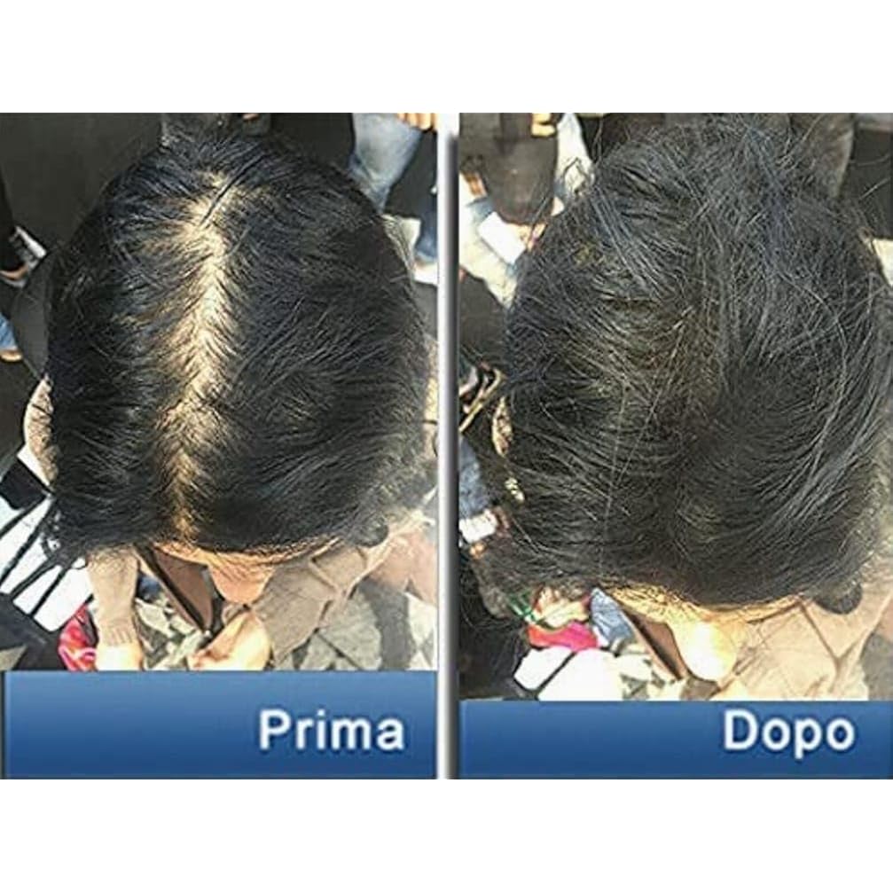 Pantogar Specific Treatment For Hair And Nails 90 Caps