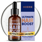 Moerie Ultimate Hair Growth Serum For Natural Hair Regrowth & Thickening - Anti Thinning & Hair Loss Treatment For Women - Rapid Hair Growth Products - Scalp Oil Alternative - 1.69 Fl Oz / 50 Ml