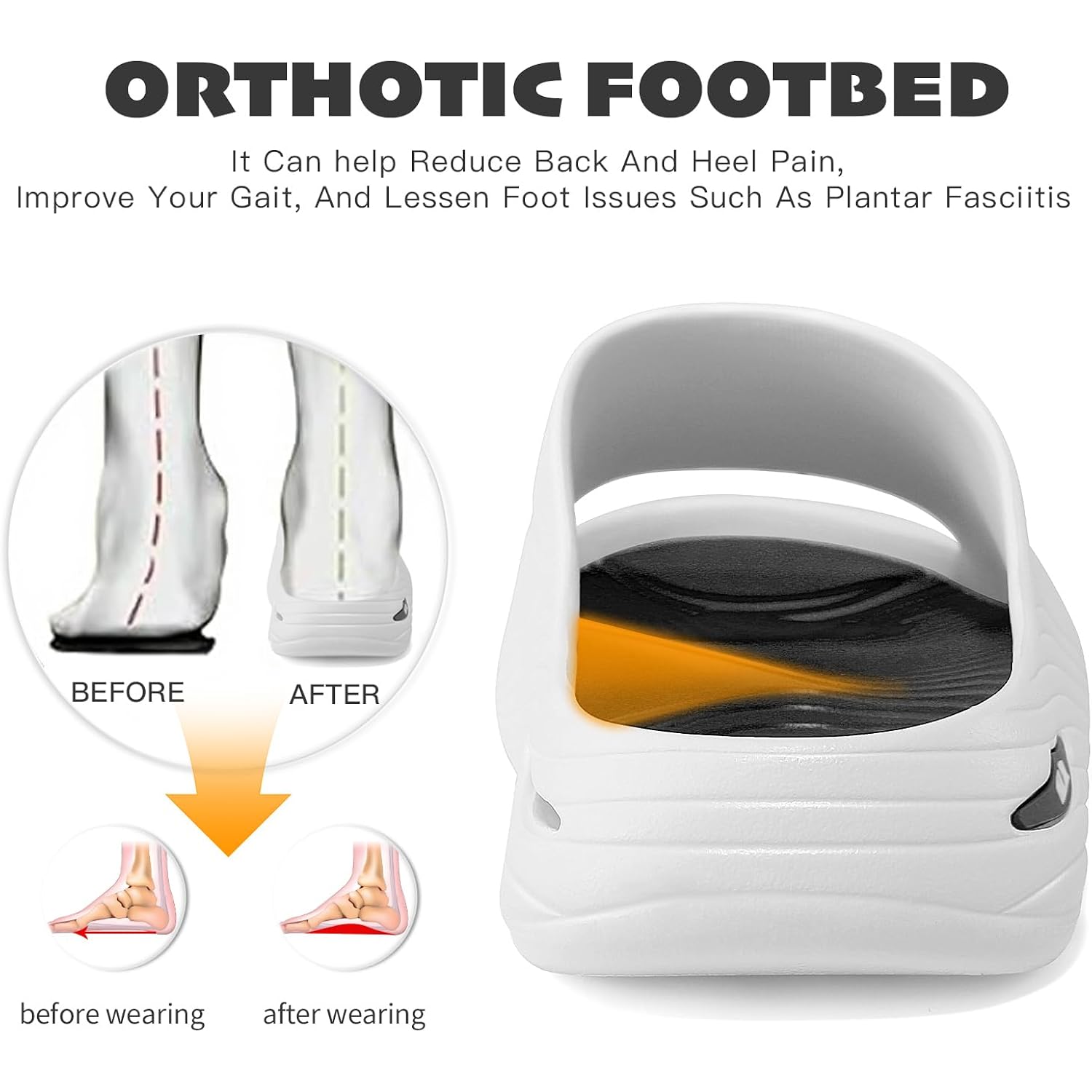 Mens Recovery Slides - Orthotic Arch Support Sandals For Plantar Fasciitis,Comfortable Cushioned Sport Slides With Open Toe, Reduces Foot & Joint Stress, Size7-13