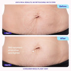 Gopure Tighten & Smooth Belly Cream - Clinically Tested With Microtight4 Complex To Reduce The Appearance Of Cellulite & Stretch Marks - Quick Absorbing For Smoother, Firmer-Looking Skin, 4.25Oz