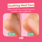 Handmade Heroes Foot Mask for Cracked Heel Treatment Gel Mask for Dry Cracked Feet Women with Jojoba & Vitamin E Intensive Overnight Heel Repair Moisturizing Overnight 2pc