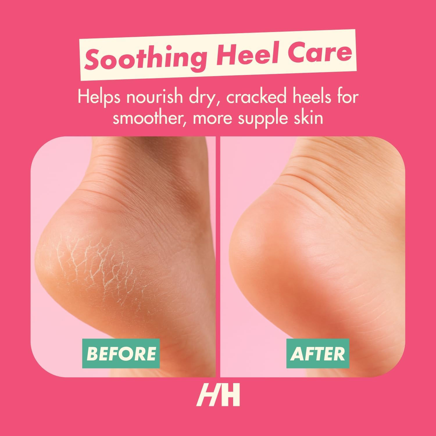Handmade Heroes Foot Mask for Cracked Heel Treatment Gel Mask for Dry Cracked Feet Women with Jojoba & Vitamin E Intensive Overnight Heel Repair Moisturizing Overnight 2pc