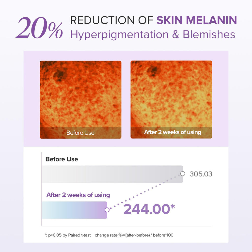 Mary&May Tranexamic Acid + Glutathione Eye Cream (30G) - Korean Skincare For Dark Circles & Uneven Tone - Fragrance-Free Under Eye Cream For Dark Spots & Hyperpigmentation 1.06Oz.