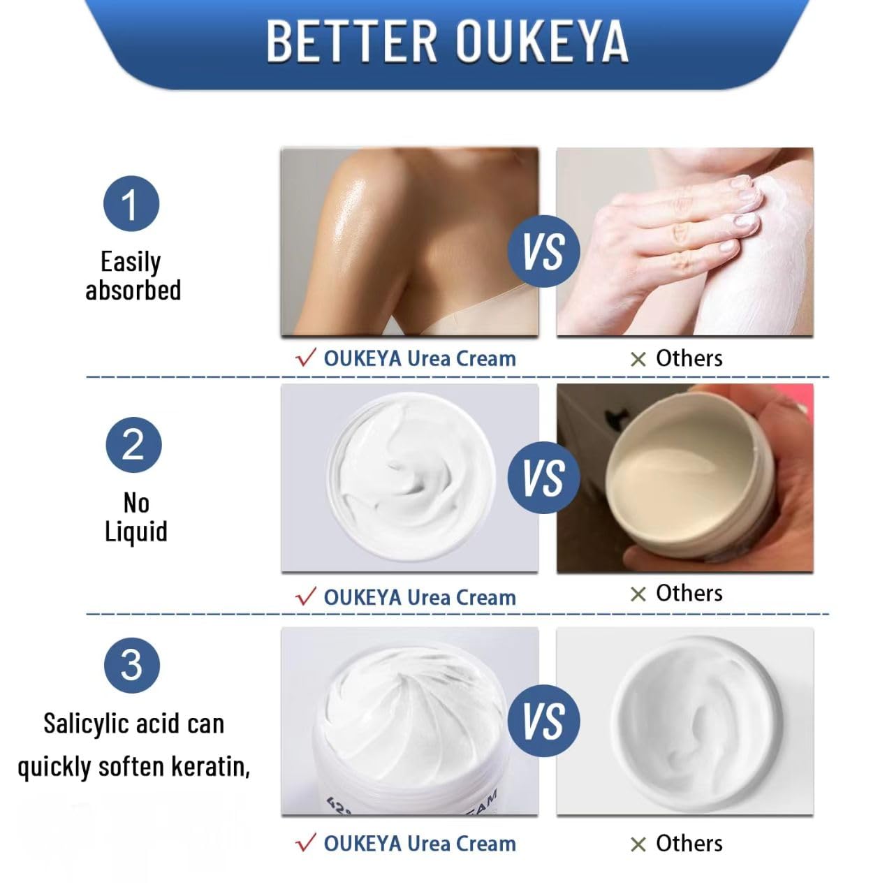 OUKEYA Urea Cream 42% plus Salicylic Acid 2% - Foot & Hand Cream to Moisturize, Soften & Smooth Dry, Cracked, Rough Skin on Heels, Knees & Elbows, 5.29 oz