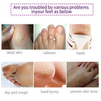 Foot Peel Mask 5 Pack,Lavender Exfoliating Foot Masks, Soft Smooth Touch Natural Exfoliator for Dry Dead Skin, Callus, Repair Rough Heels,Gifts for Women Mom and Men