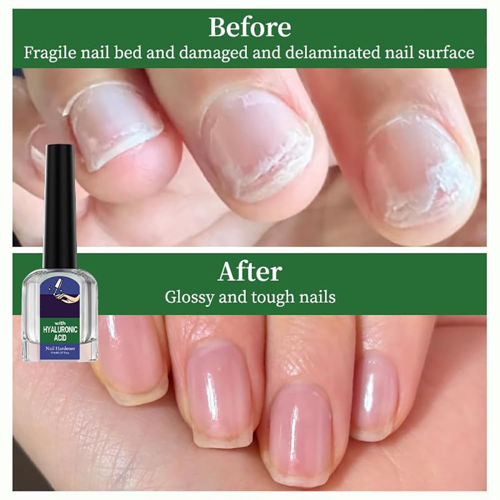 Oprtuisi Nail Care Cuticle Oil, 2-Pack Fast Absorbing Repair Serum for Cracked Cuticles, Suitable for Manicures and Home Care