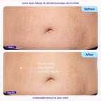 Gopure Tighten & Smooth Belly Cream - Clinically Tested With Microtight4 Complex To Reduce The Appearance Of Cellulite & Stretch Marks - Quick Absorbing For Smoother, Firmer-Looking Skin, 4.25Oz