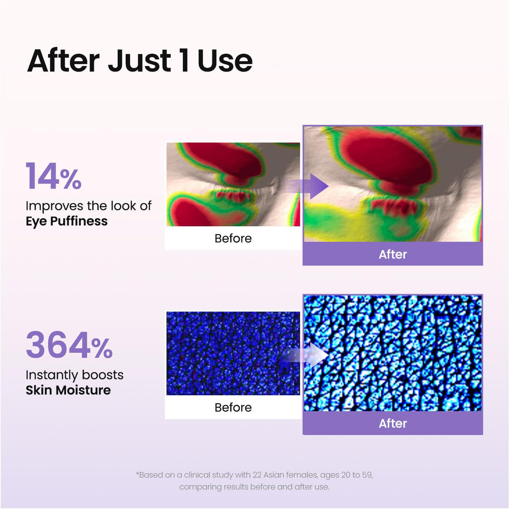 Biodance Caviar Pdrn Eye Patches, Nourishing Under Eye Patches For Dark Circles, Depuffing Eye Mask For Puffy & Tired Eyes, Travel Essentials & Self Care Gifts For Women, Korean Skin Care (60 Count)