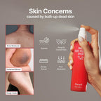 Parnell Aha Omija Ceramic Body Peeling Spray – Aha Bha Pha Body Exfoliant For Keratosis Pilaris, Strawberry Legs, Dark Spots & Dead Skin Remover – Exfoliant Body Mist For Rough Skin 4.60 Fl.Oz