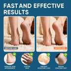 Urea Cream 60% Plus Salicylic Acid 2%, Urea Cream 60 Percent for Feet Maximum Strength, Foot Cream for Dry Heels Cracked