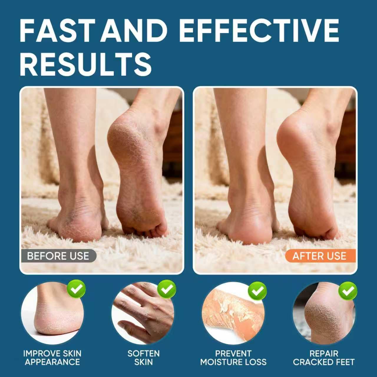 Urea Cream 60% Plus Salicylic Acid 2%, Urea Cream 60 Percent for Feet Maximum Strength, Foot Cream for Dry Heels Cracked