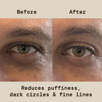 By Dwayne Johnson Fast-Acting Under Eye Patches For Men | Ageless Action To Reduce Puffiness, Dark Circles And Fine Lines | Made With Niacinamide, Hyaluronic Acid, Caffeine | 6Ct