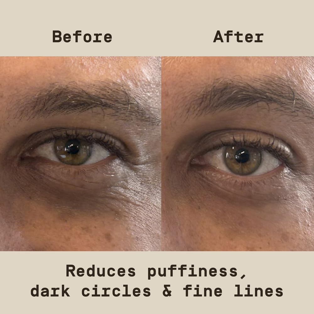 By Dwayne Johnson Fast-Acting Under Eye Patches For Men | Ageless Action To Reduce Puffiness, Dark Circles And Fine Lines | Made With Niacinamide, Hyaluronic Acid, Caffeine | 6Ct