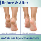 Pedifix Podiatrists' Choice 20% Urea Callus Control Extra Strength Foot Cream 4 Oz. (113g) - Professional Treatment for Dry, Cracked Feet, Callus & Foot Care Relief
