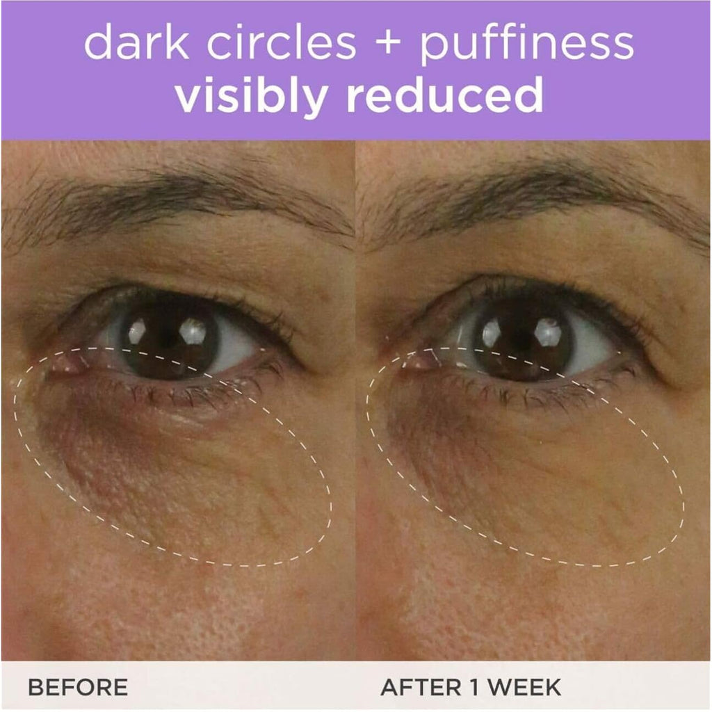 Tatcha The Brightening Eye Cream | Brightening & Dark Circle Reduction With Vitamin C For Bight, Firm Undereyes, 15 Ml / 0.5 Fl. Oz.
