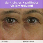 Tatcha The Brightening Eye Cream | Brightening & Dark Circle Reduction With Vitamin C For Bight, Firm Undereyes, 15 Ml / 0.5 Fl. Oz.