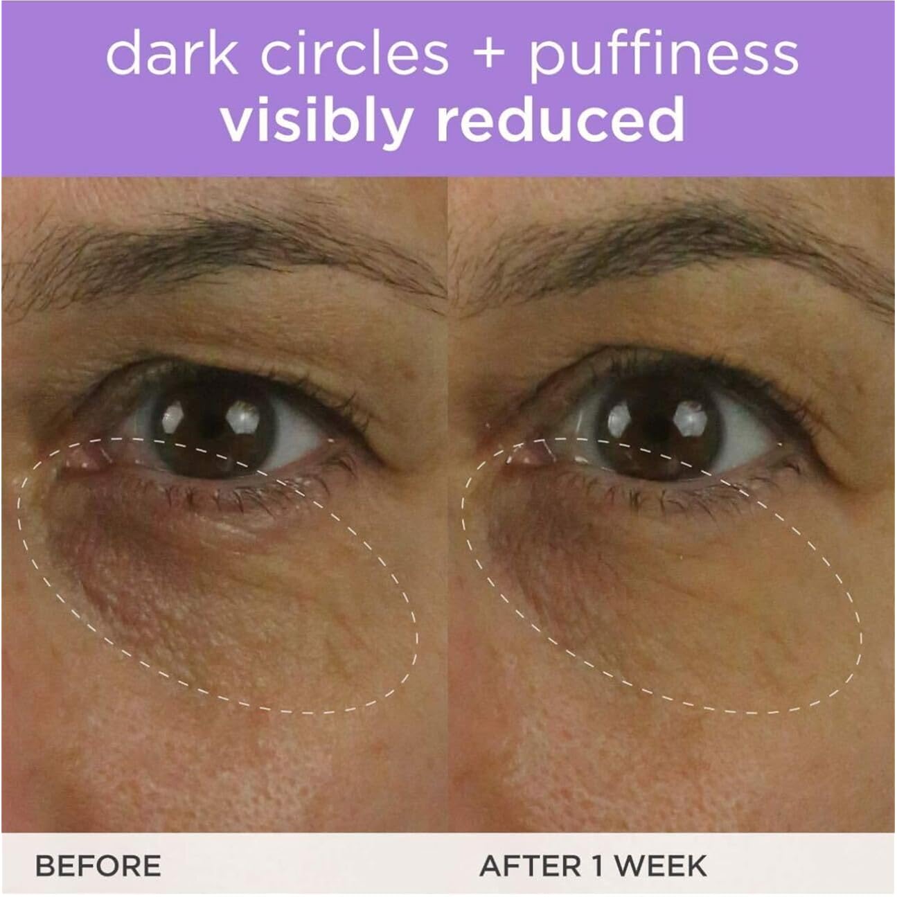 Tatcha The Brightening Eye Cream | Brightening & Dark Circle Reduction With Vitamin C For Bight, Firm Undereyes, 15 Ml / 0.5 Fl. Oz.