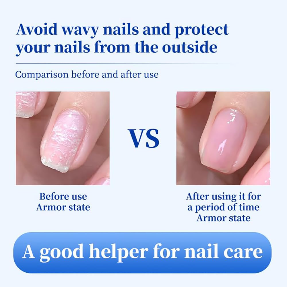 Oprtuisi Nail Care Cuticle Oil, 2-Pack Fast Absorbing Repair Serum for Cracked Cuticles, Suitable for Manicures and Home Care