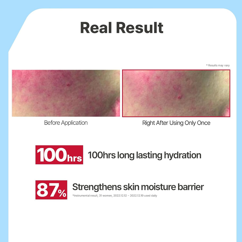 Illiyoon Ceramide Ato Lotion 528Ml(17.85Oz) | Daily Moisturizing Lotion For All Skin Types | Deep Moisturizing And Soothing Effect | Korean Skin Care