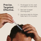 Keeps Minoxidil Solution 5% for Men - Extra Strength Topical Hair Regrowth Treatment - Non-Greasy Scalp Solution - Clinically Proven to Increase Hair Growth - 3 Month Supply (3 x 2 fl oz Bottles)